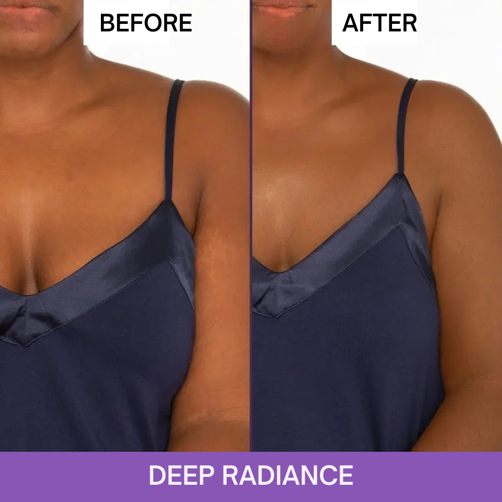 Body Coverage Perfector™